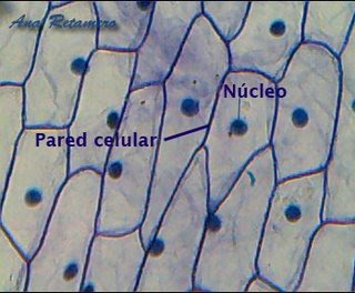 Resultado de imagen para observación de la celula vegetal